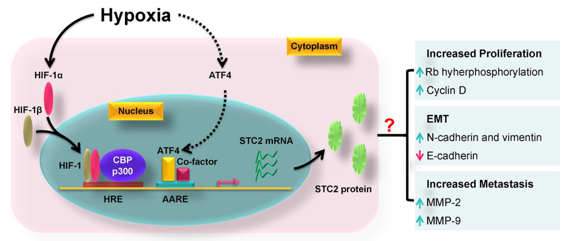 STC2：一種通用的腫瘤生物標(biāo)志物和潛在的治療靶點